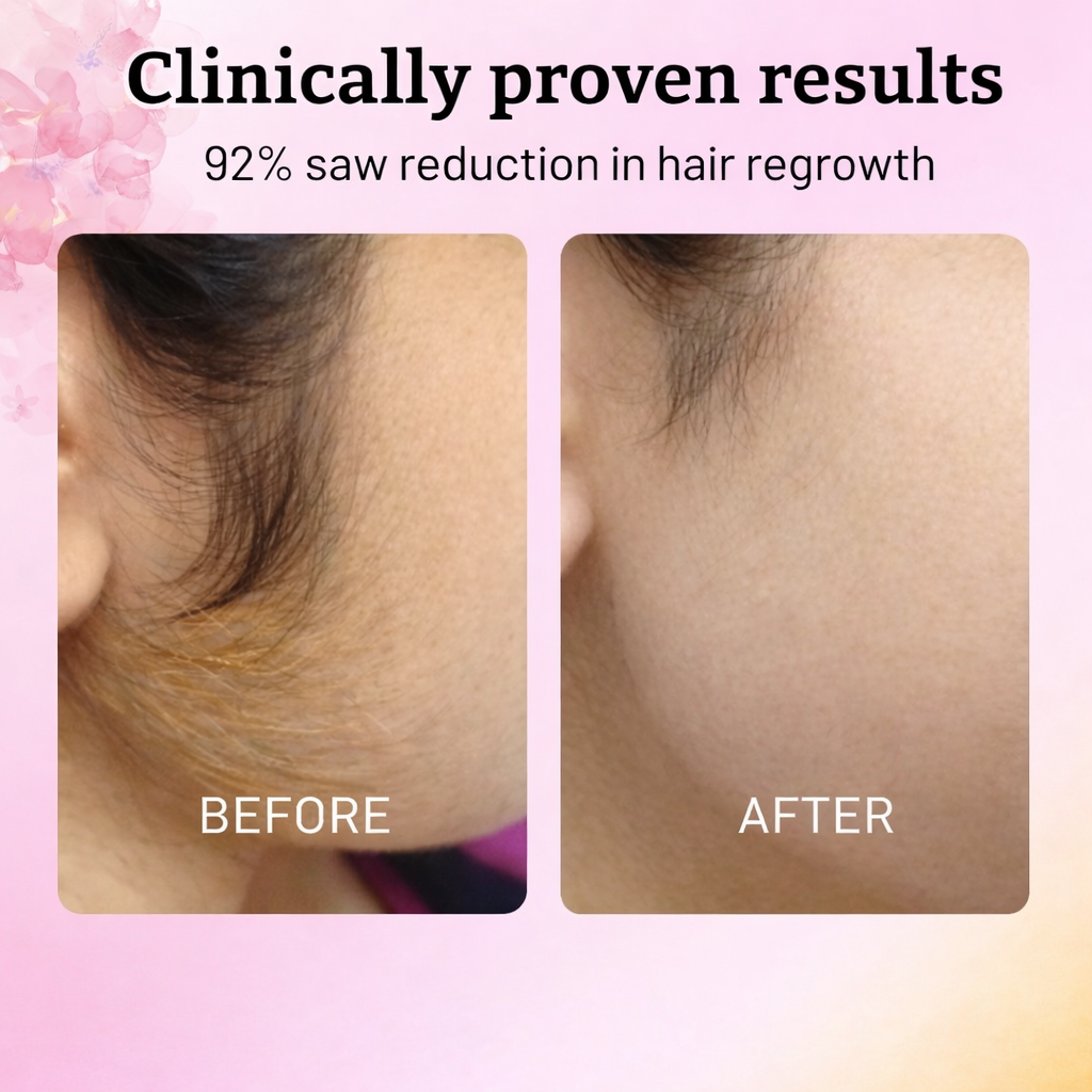 Cyperus Rotundus Oil To Reduce Hair Growth